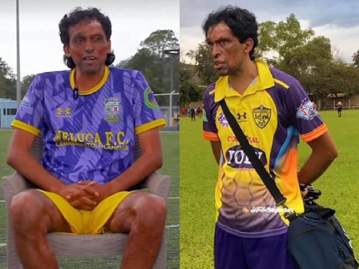 Revuelo: Pedro Joaquín Amador sorprende al debutar con club de Honduras