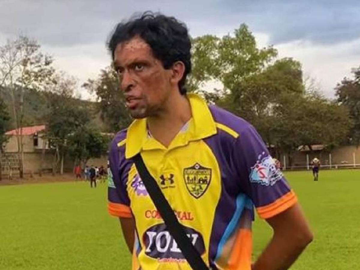 Revuelo: Pedro Joaquín Amador sorprende al debutar con club de Honduras