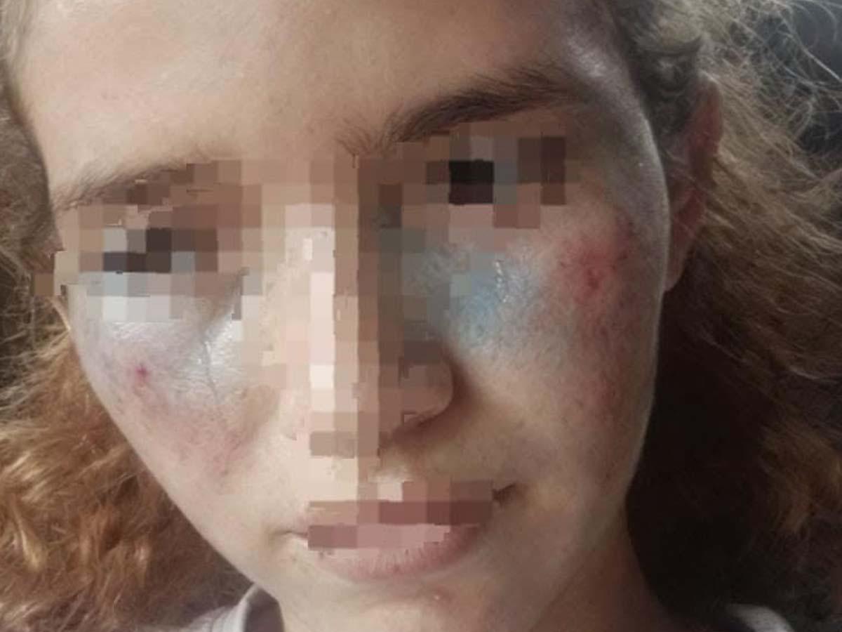 Joven usó inteligencia artificial para fingir su propio secuestro y terminó capturada