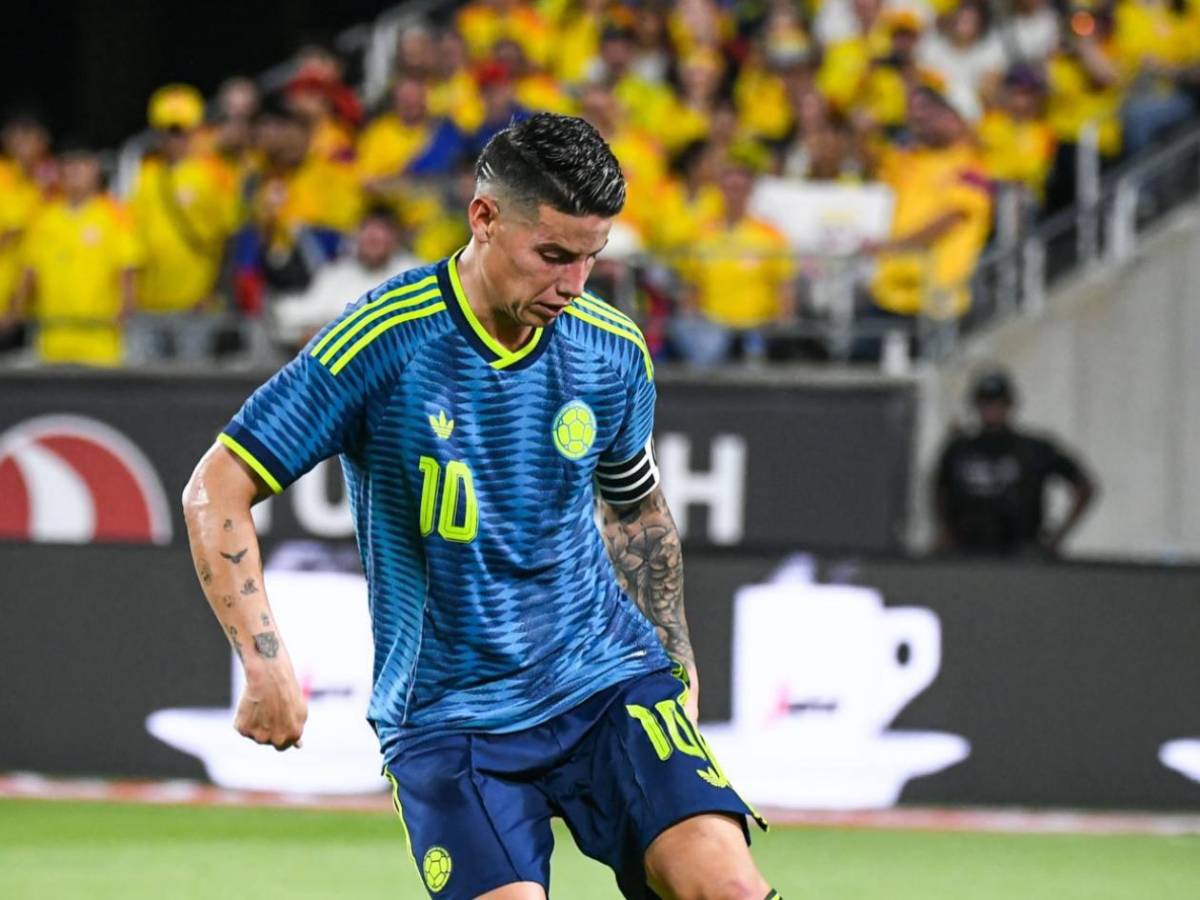 ¿James Rodríguez sufre de rabdomiólisis mortal? Surge noticia sobre el colombiano