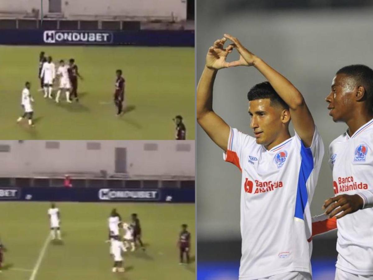 Olimpia sufre nueva baja: José Mario Pinto es castigado tras agresión