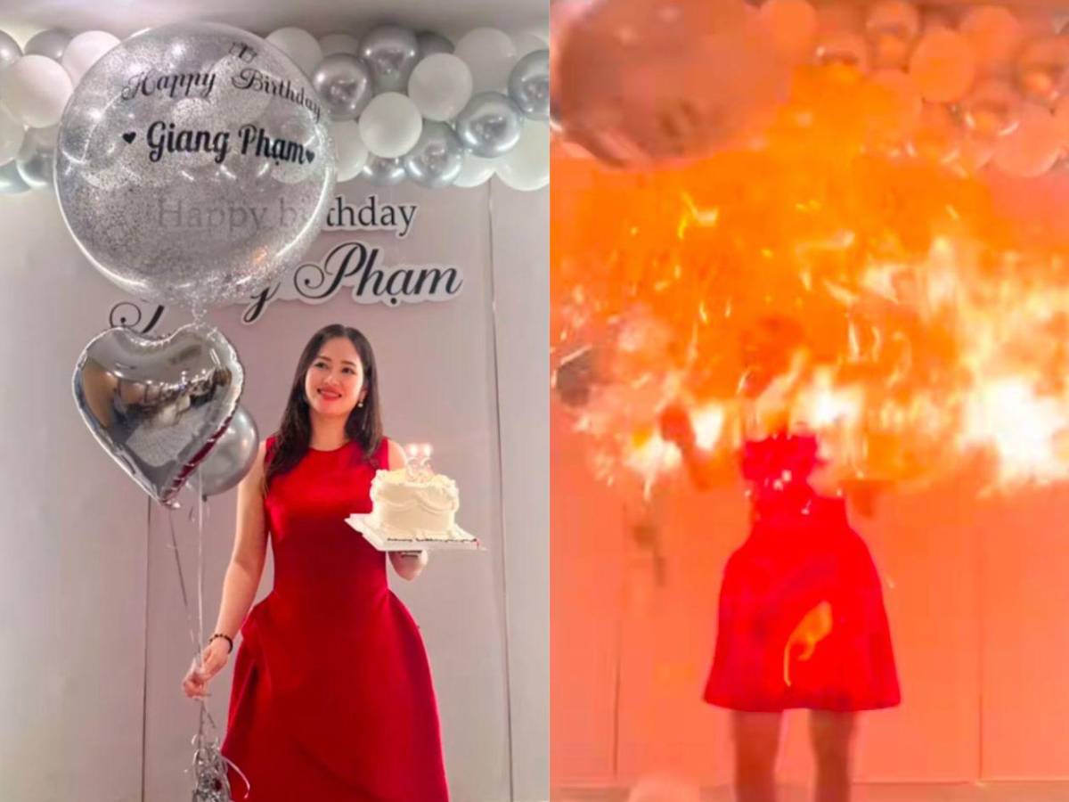 Cumpleaños fatal: Joven se incendia el rostro al rozar velas con globo de helio
