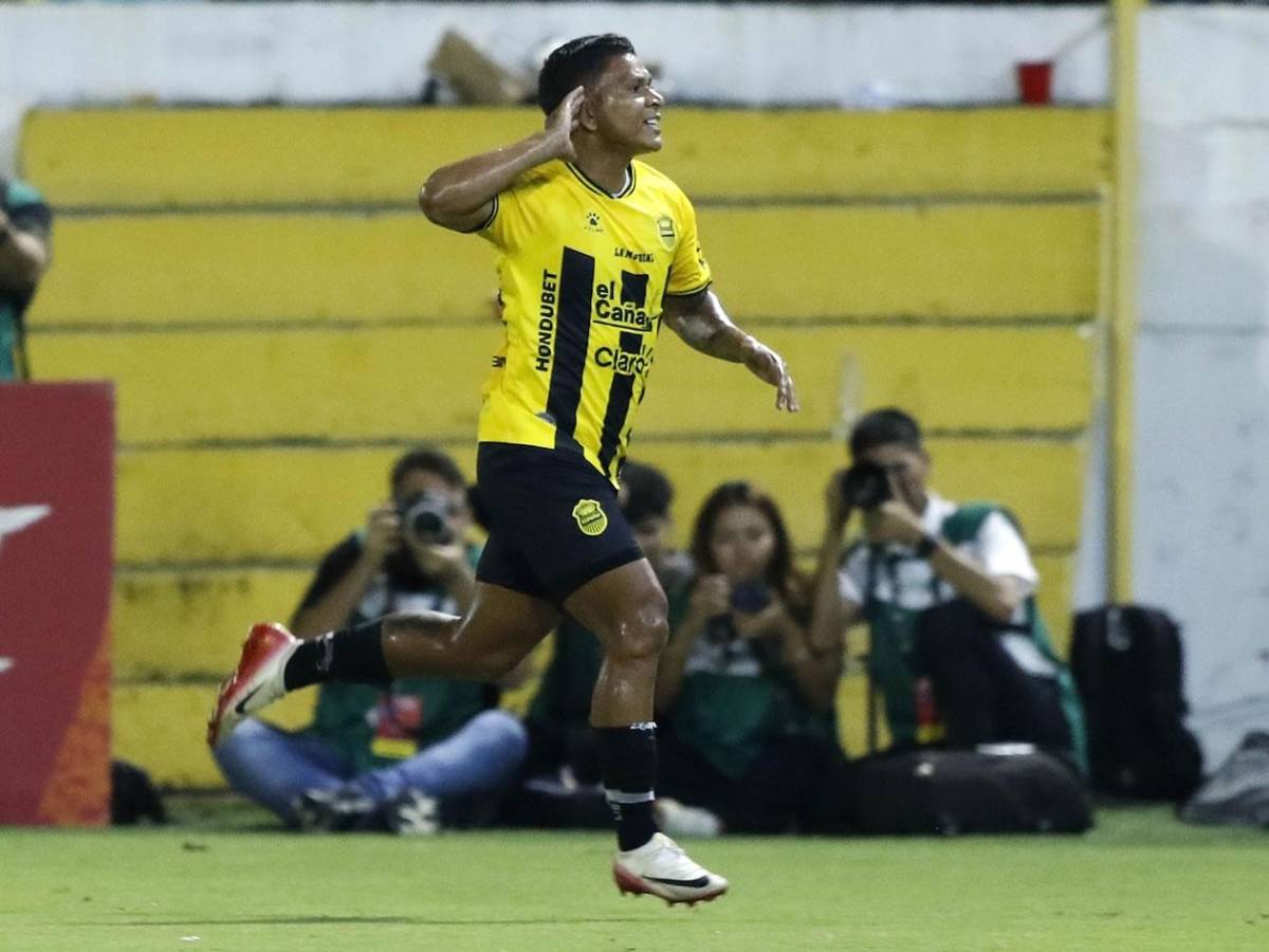 La alegría de Real España, grave lesión, jugador caminó descalzoy linda chica enamora