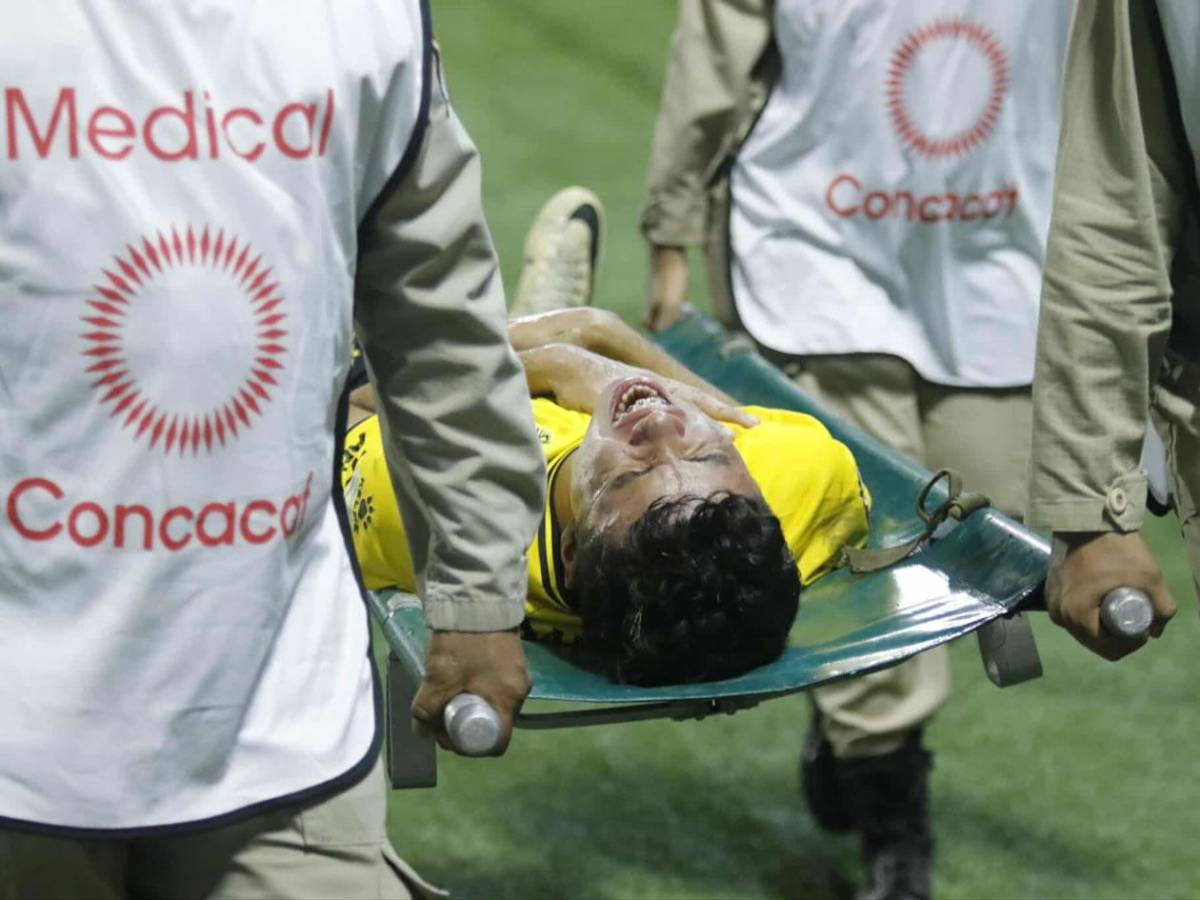 La alegría de Real España, grave lesión, jugador caminó descalzoy linda chica enamora