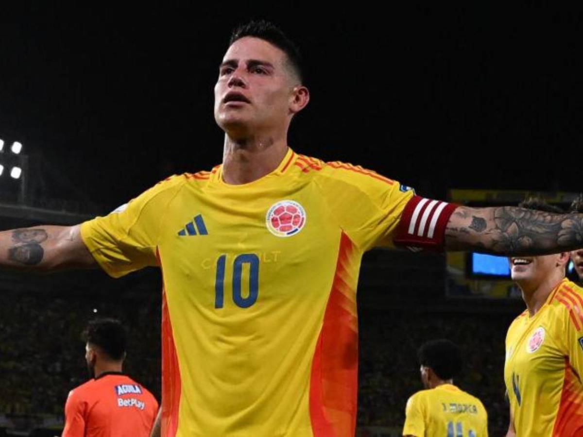 James Rodríguez en alerta: hospitalizado a dos meses del Mundial 2026