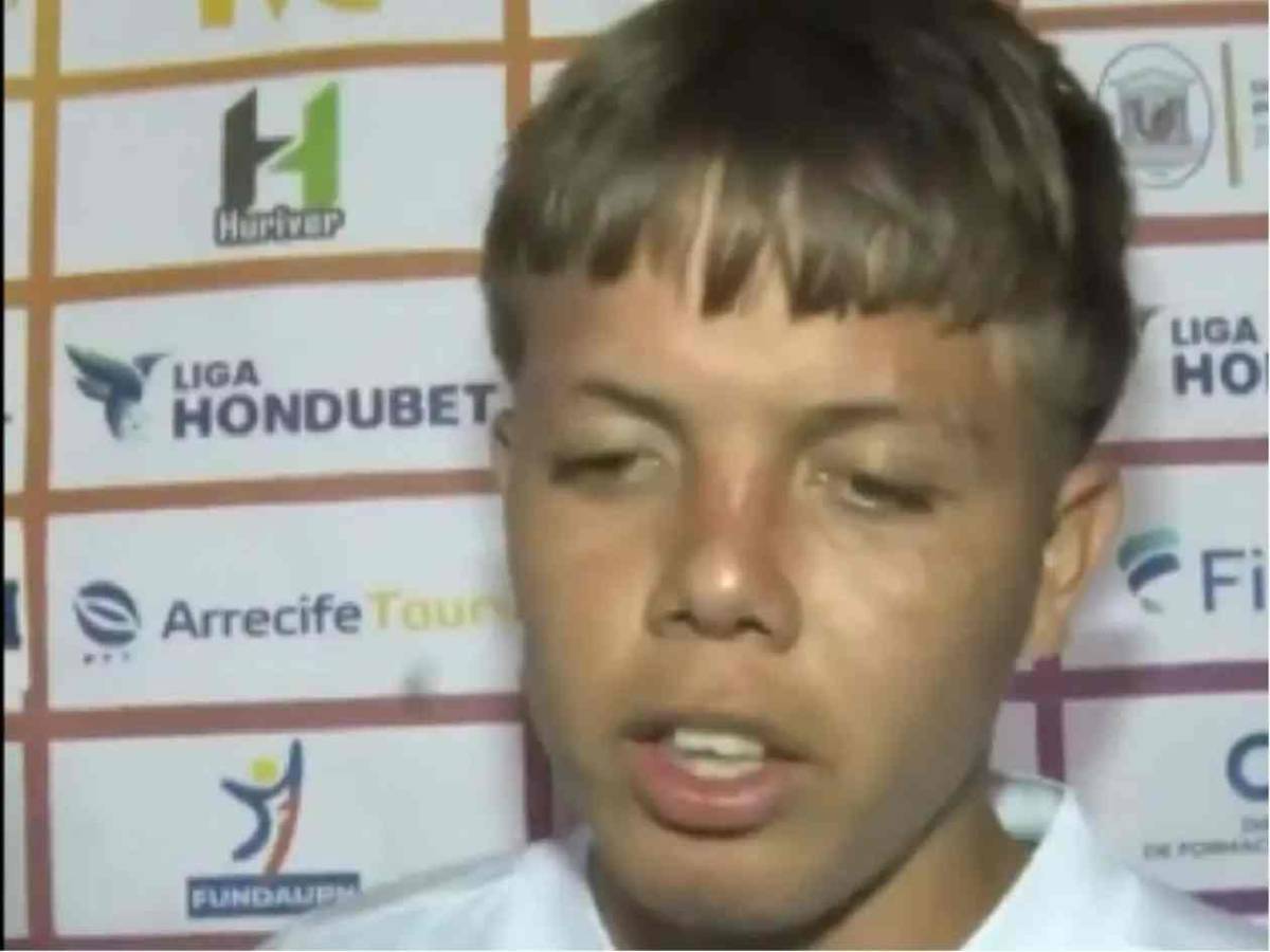 Jugador se estrella con muro y, ¿quién es el 'chelito' que debutó con Olimpia?