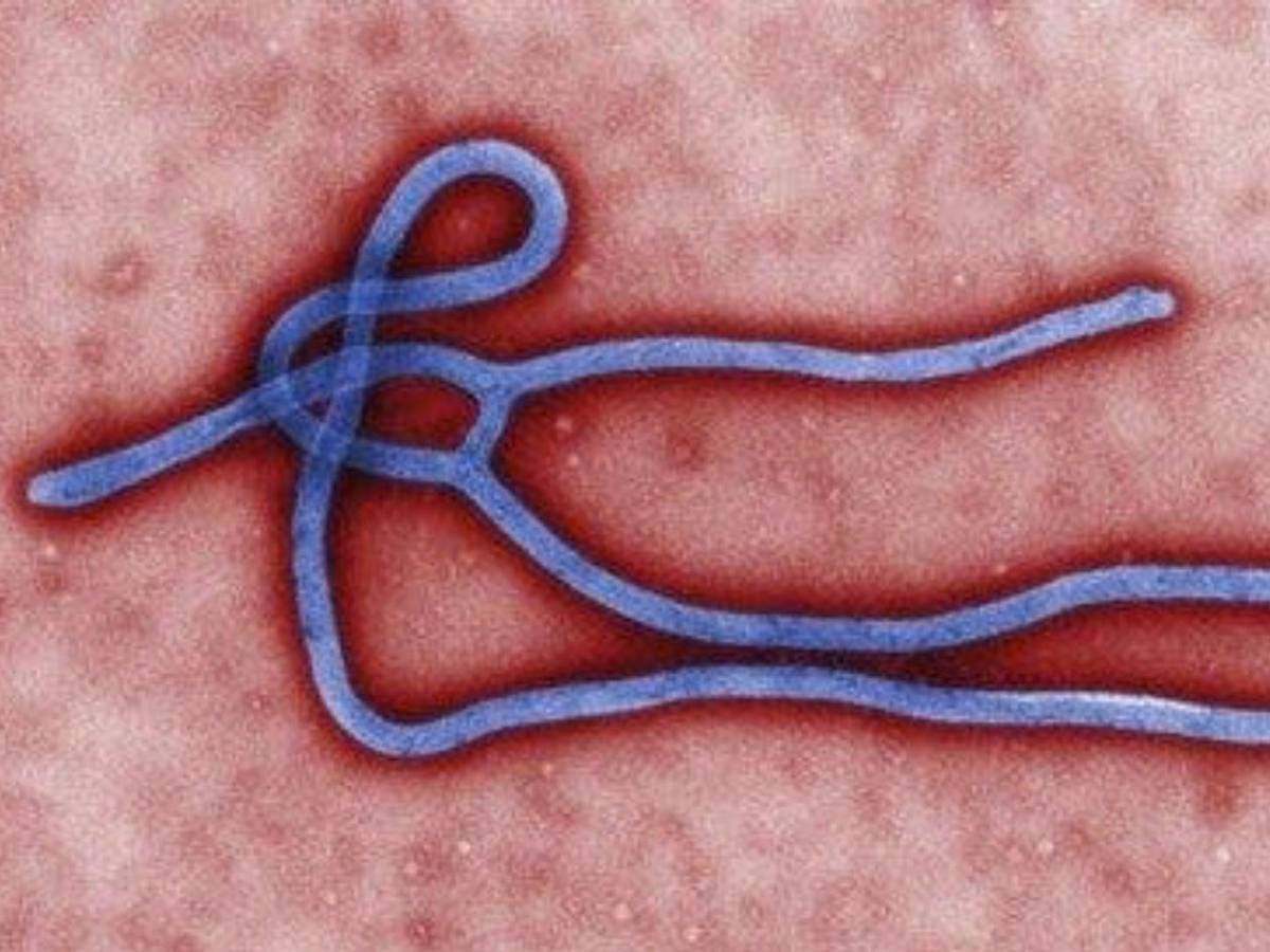 Alerta sanitaria: Reportan más de 100 muertes por casos de ébola