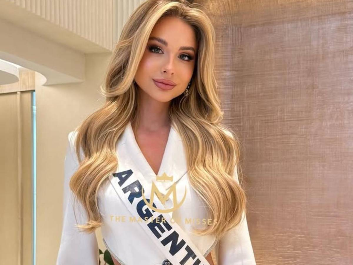 Miss Argentina 2025, Aldana Masset, revela que padece alopecia