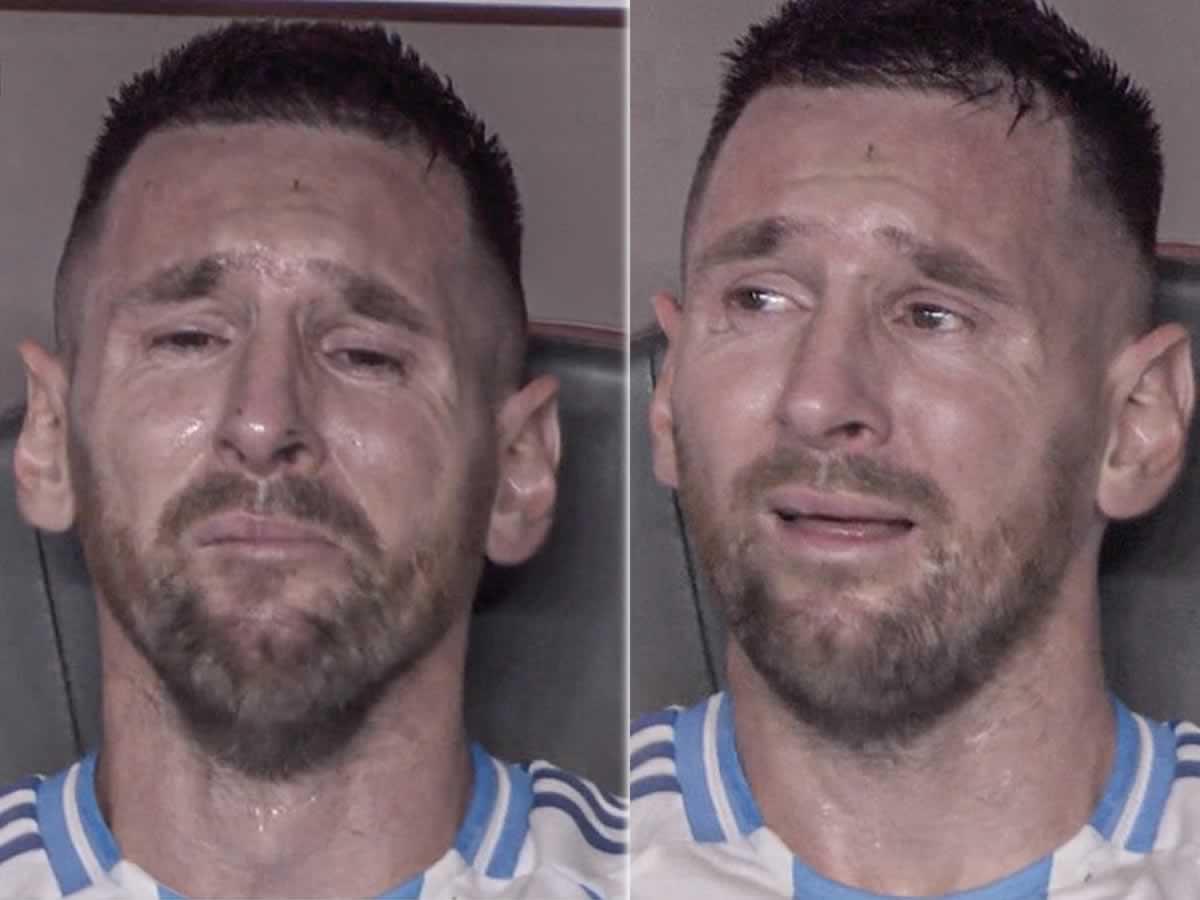 Duele verlo: Messi se va lesionado y llorando en la final de Copa América 2024