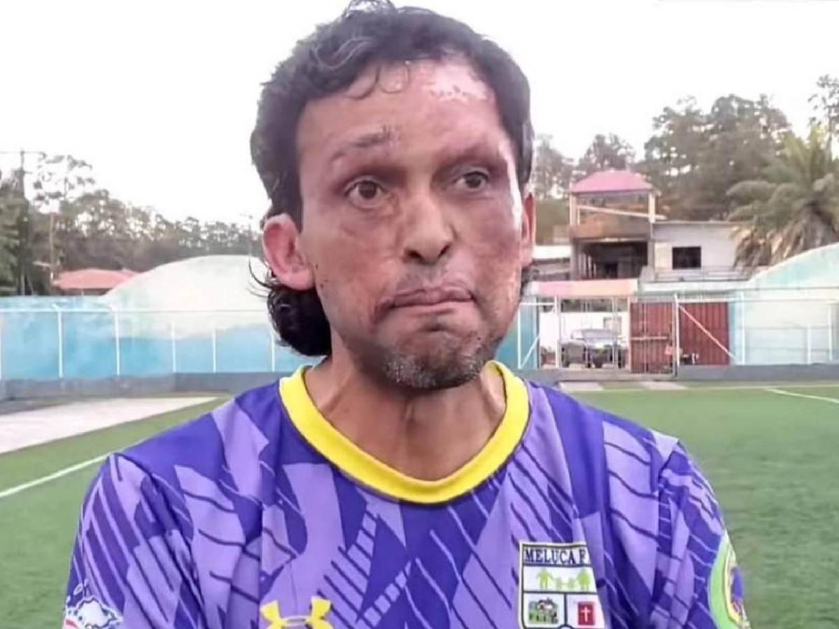 Político debutó en club de Honduras: ingresó al 90’ y esta fue su reacción