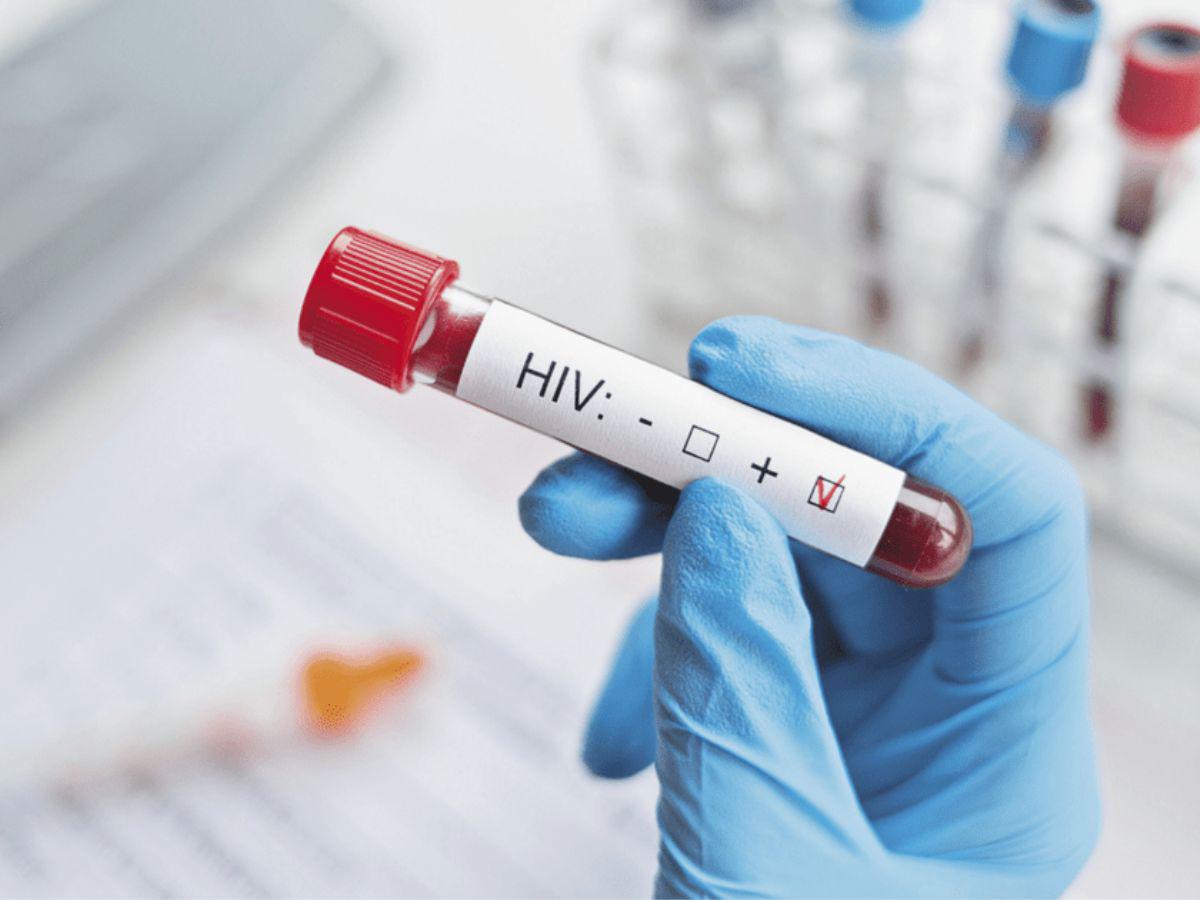 La ONU ve posible la erradicación del sida en 2030