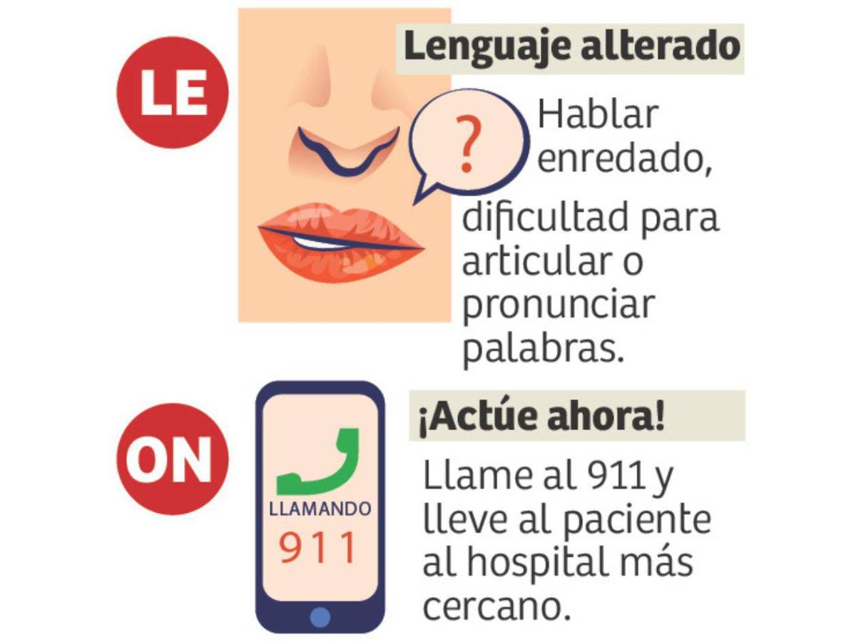 ¿Cómo reconocer a tiempo un derrame cerebral?