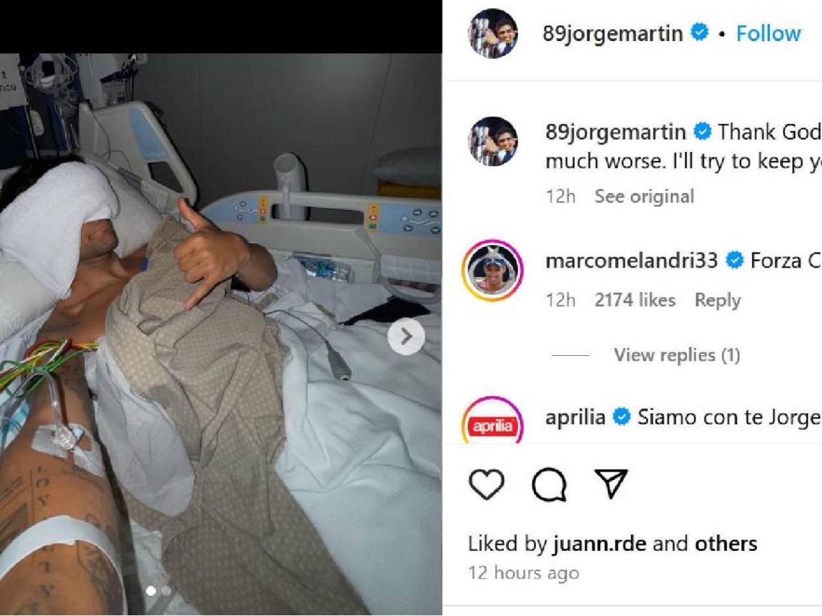 Sufrió brutal accidente y se rompió 11 costillas: las imágenes desde el hospital