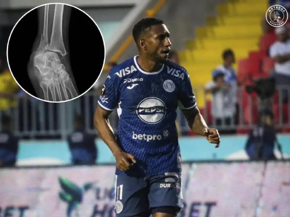 Olimpia, Motagua y Marathón con duras ausencias: revés en Copa Centroamericana