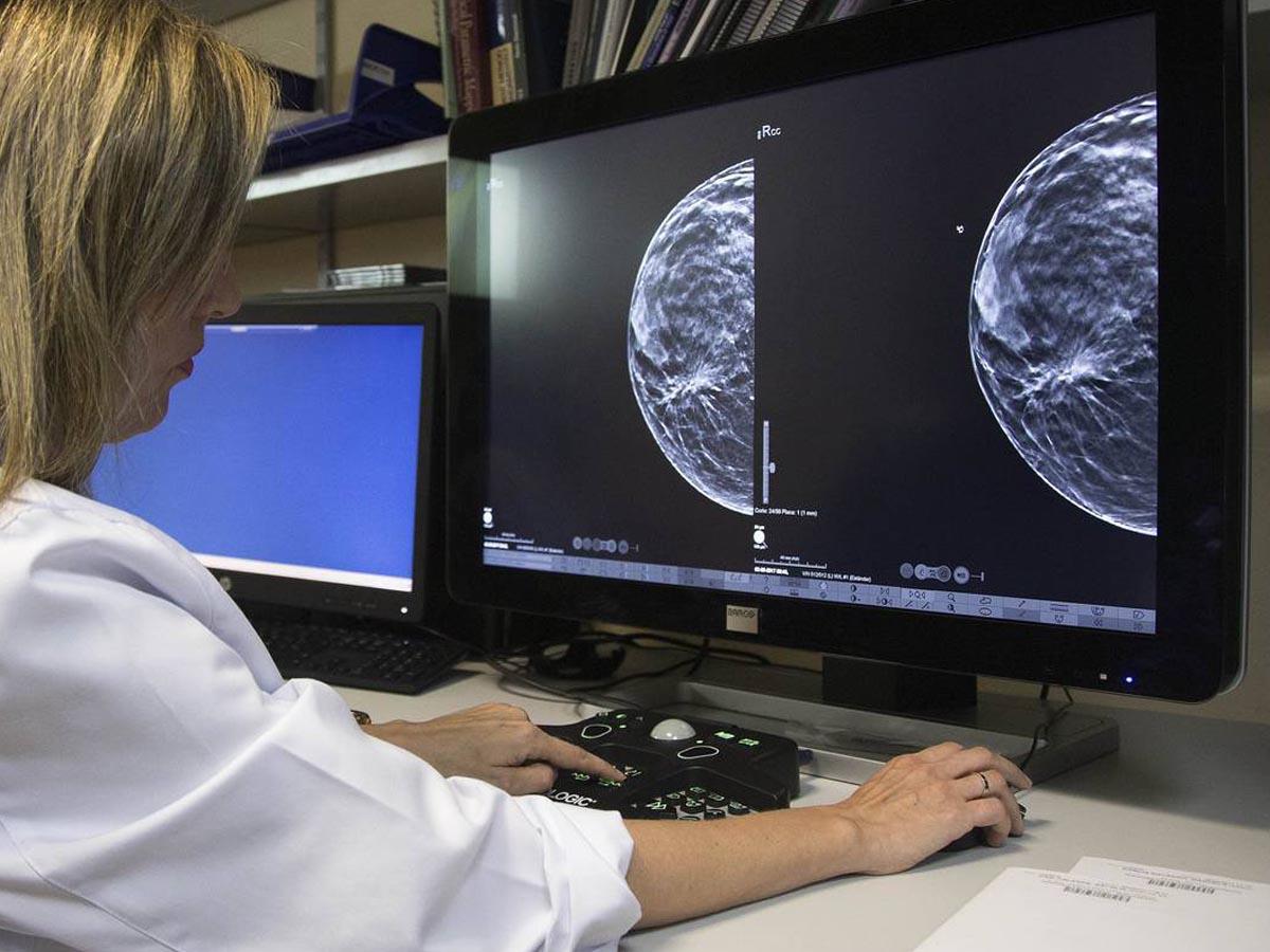 IHSS detectará cáncer de mama y pulmón en una semana