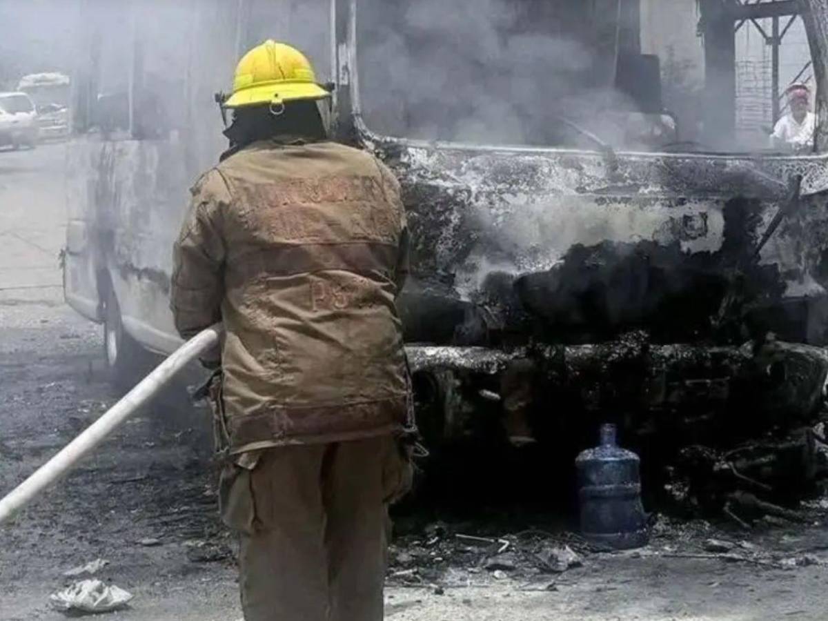 Revelan el estado clínico del hombre que sufrió quemaduras tras accidente en SPS
