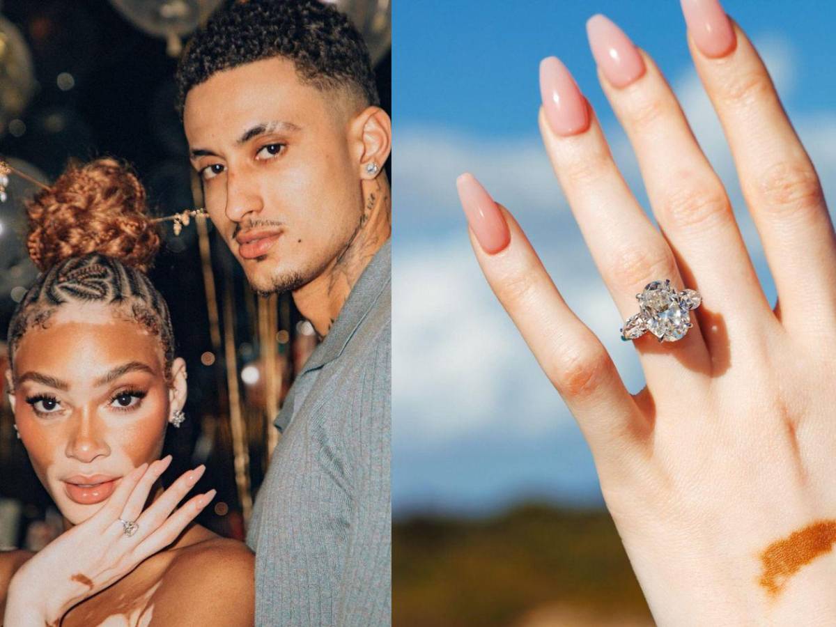 Winnie Harlow se compromete con el jugador de la NBA Kyle Kuzma
