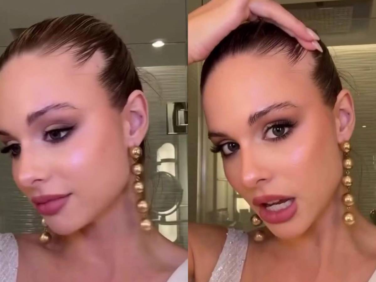 Miss Argentina 2025, Aldana Masset, revela que padece alopecia