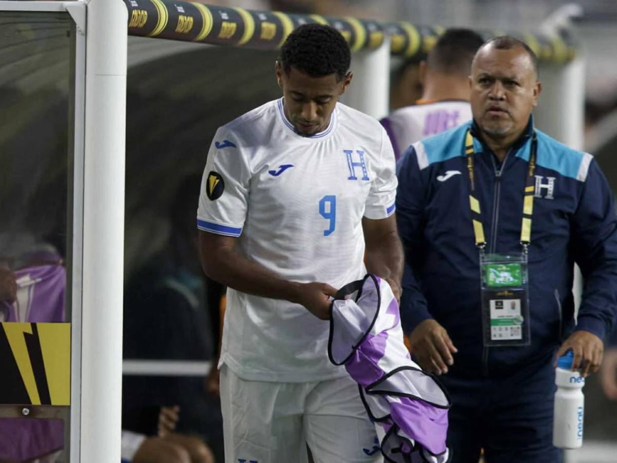 Copa Oro: Honduras perdió el tercer lugar del torneo por una curiosa razón
