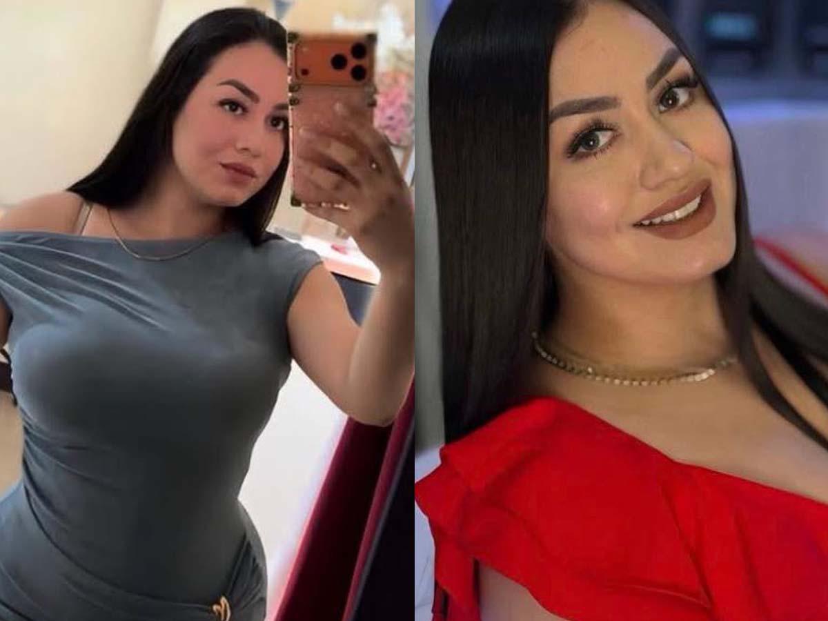 Jennyfer Reyes murió tras complicaciones de cirugía estética de glúteos y liposucción​​​​​​