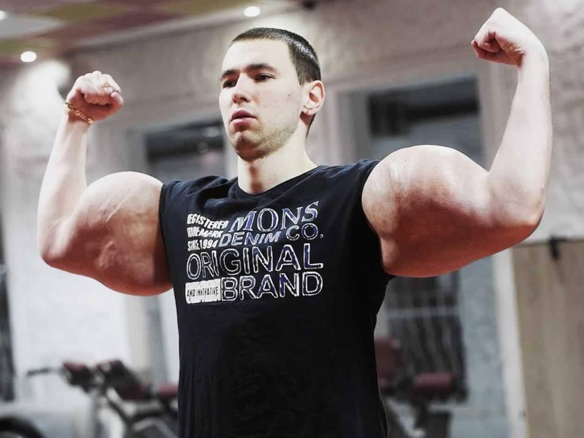 Deportista 'Popeye ruso' hace dramática confesión: podría perder los dos brazos