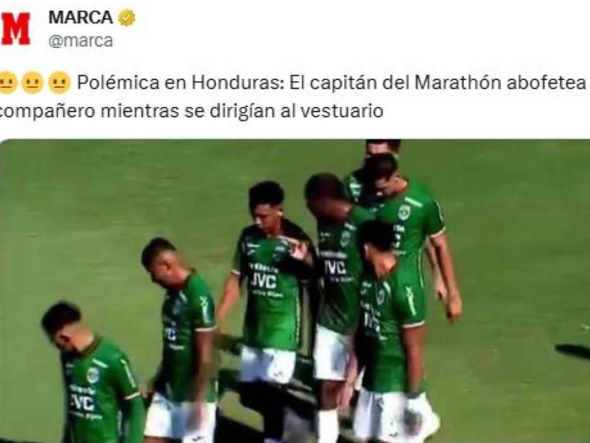 Alexy Vega reacciona: Exigen castigo a Anangonó y su cachetada le da la vuelta al mundo