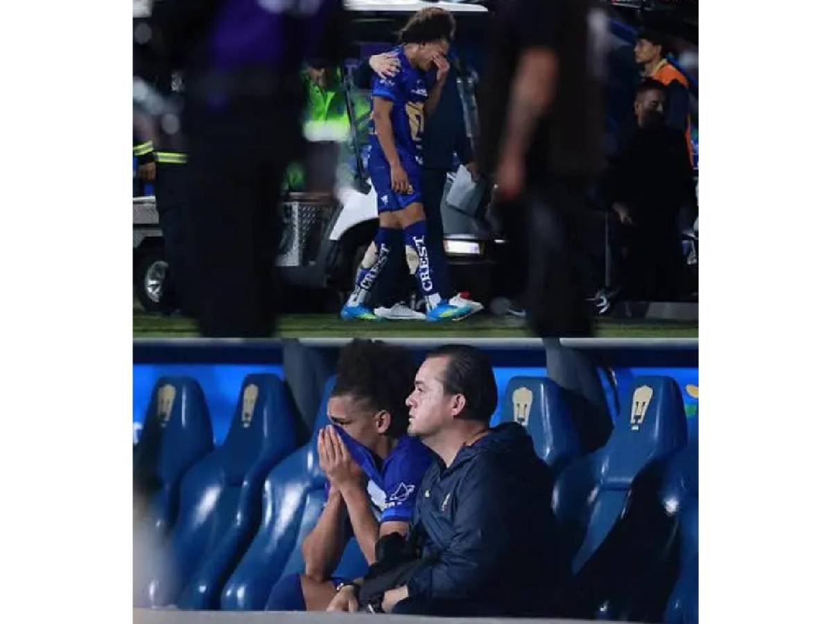 El dolor de Keylor Navas en México, euforia del campeón y preocupación por Carrasquilla