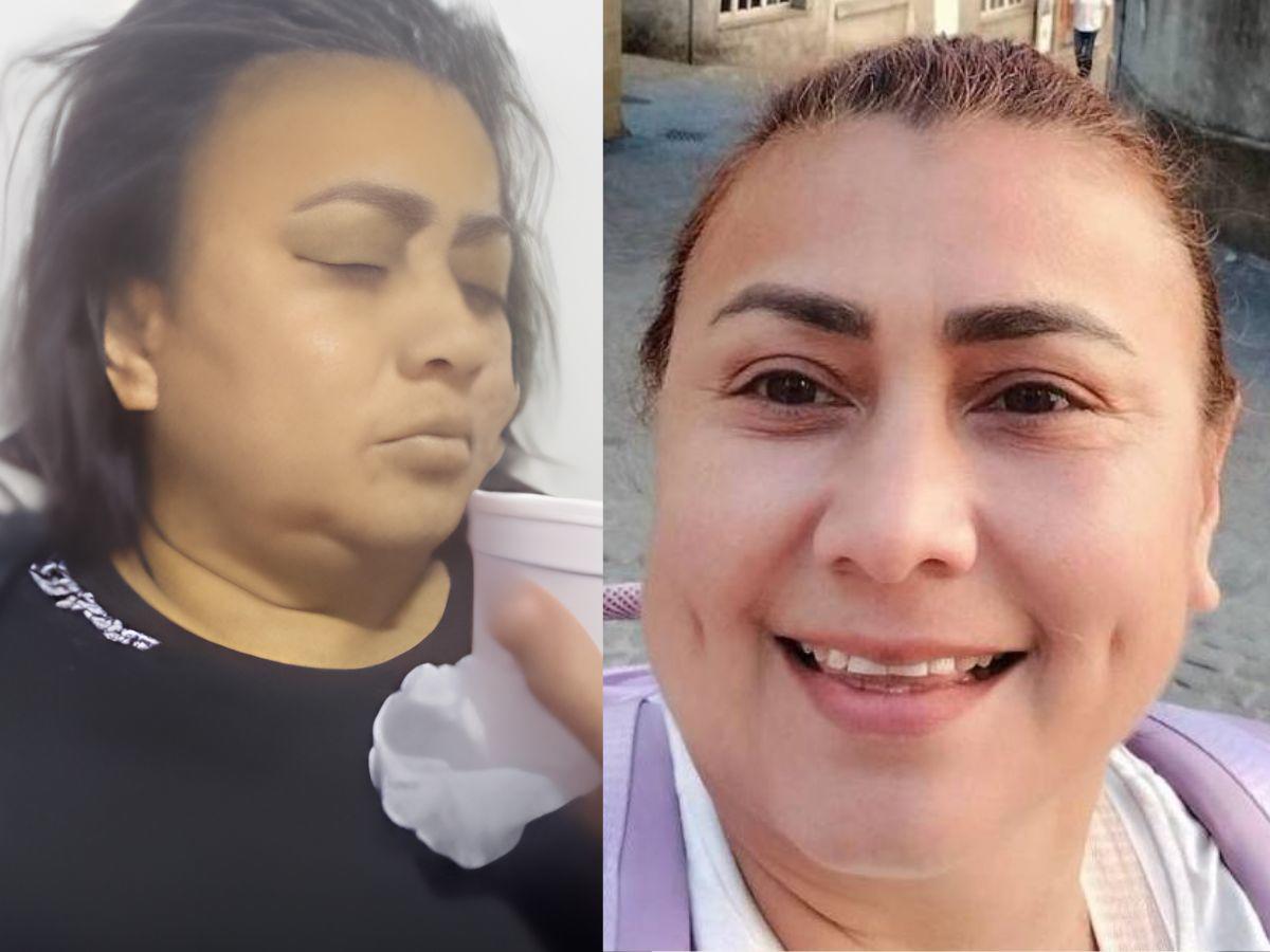 El caso de Yulixa: misterio detrás de la mujer desaparecida tras liposucción clandestina