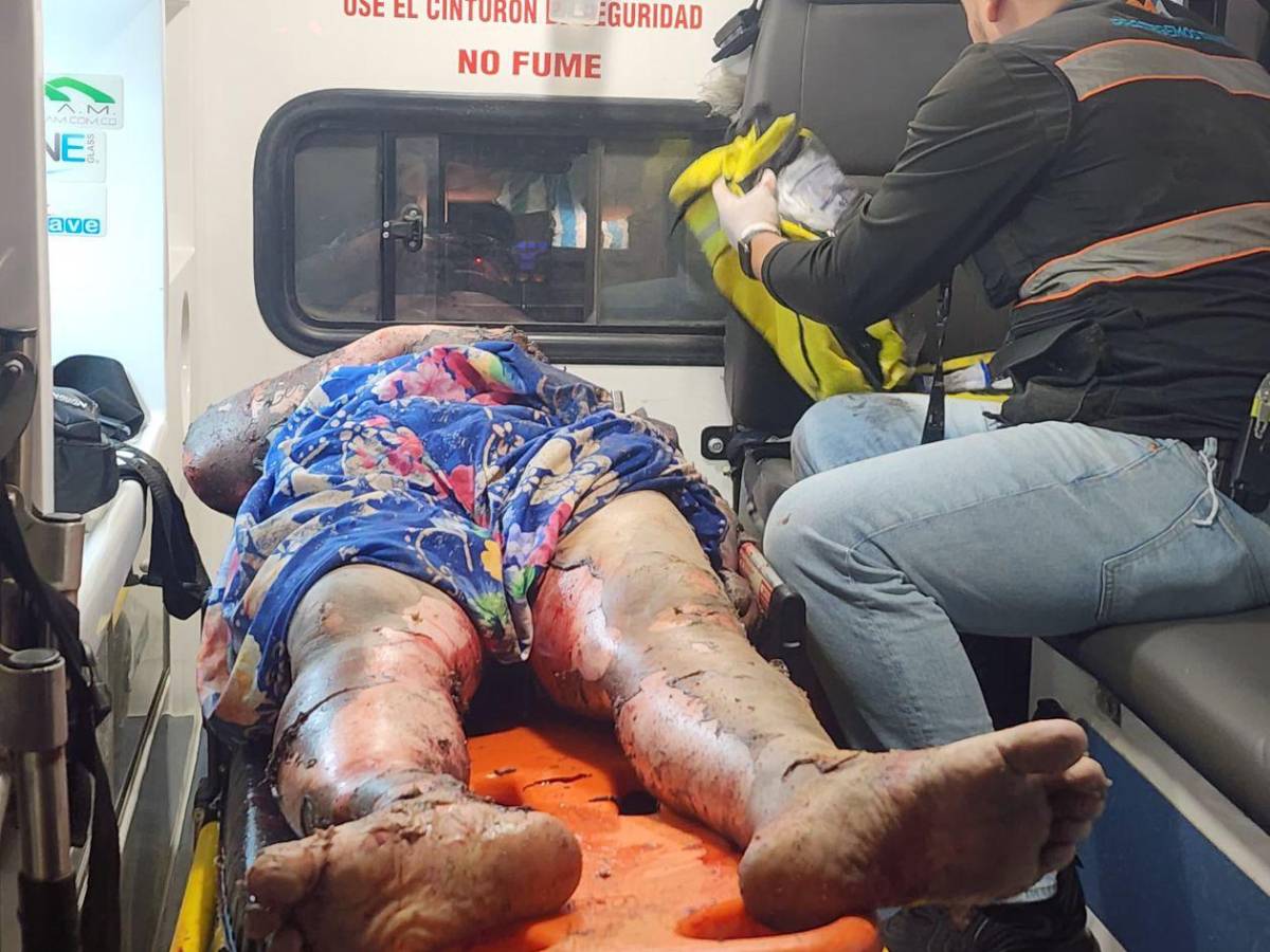 Tragedia en Chamelecón: Las  imágenes de la explosión de pólvora que dejó un muerto y dos heridos