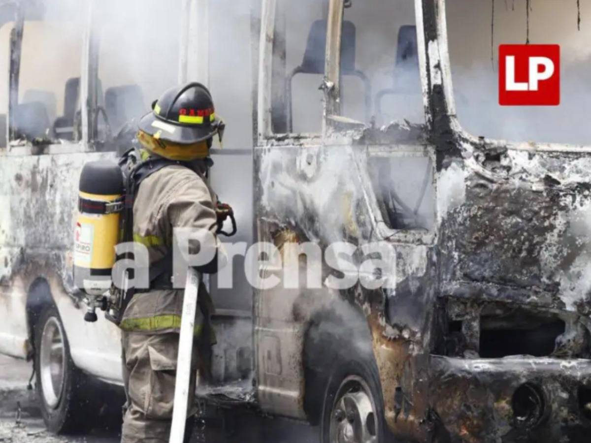 Revelan el estado clínico del hombre que sufrió quemaduras tras accidente en SPS