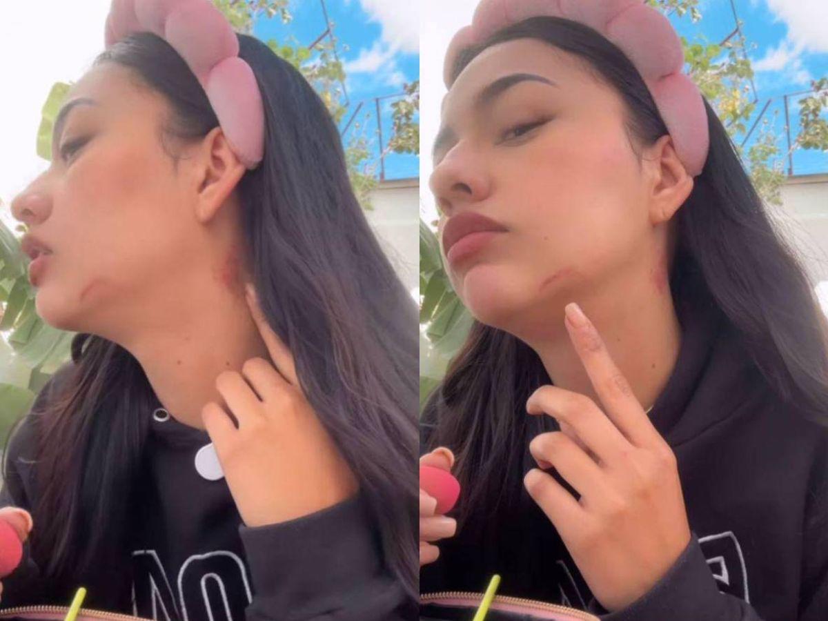 Novio de Kennia Mondragón rompe el silencio y revela del lado de quién está