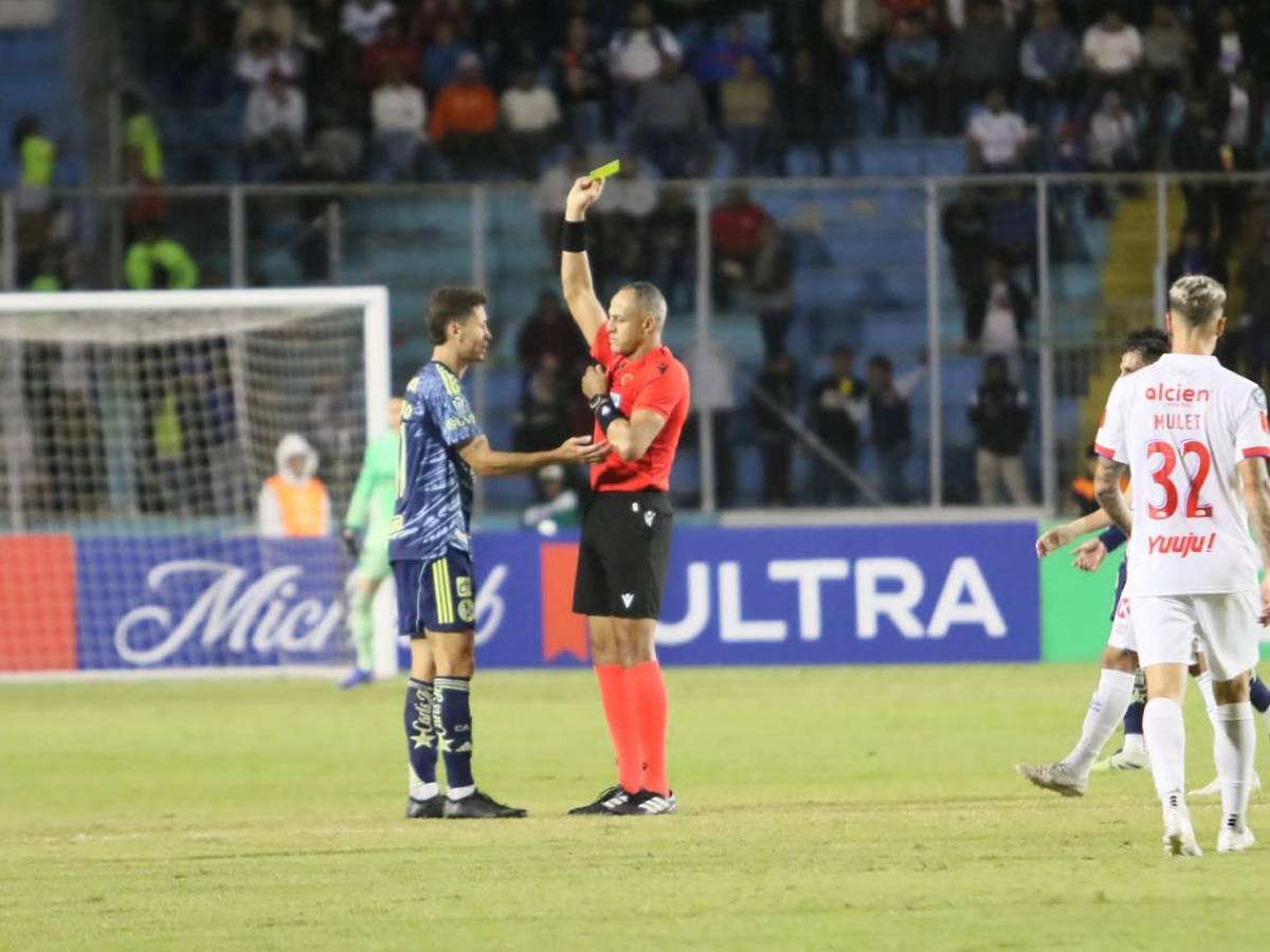 Olimpia se derrumba ante América, dedicatoria de Jorge Álvarez y novia de futbolista