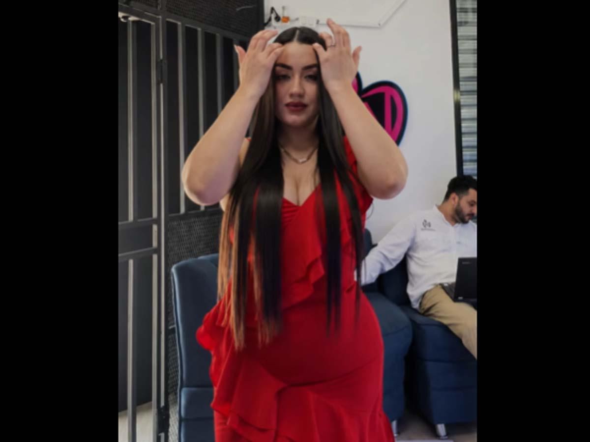 Jennyfer Reyes murió tras complicaciones de cirugía estética de glúteos y liposucción​​​​​​