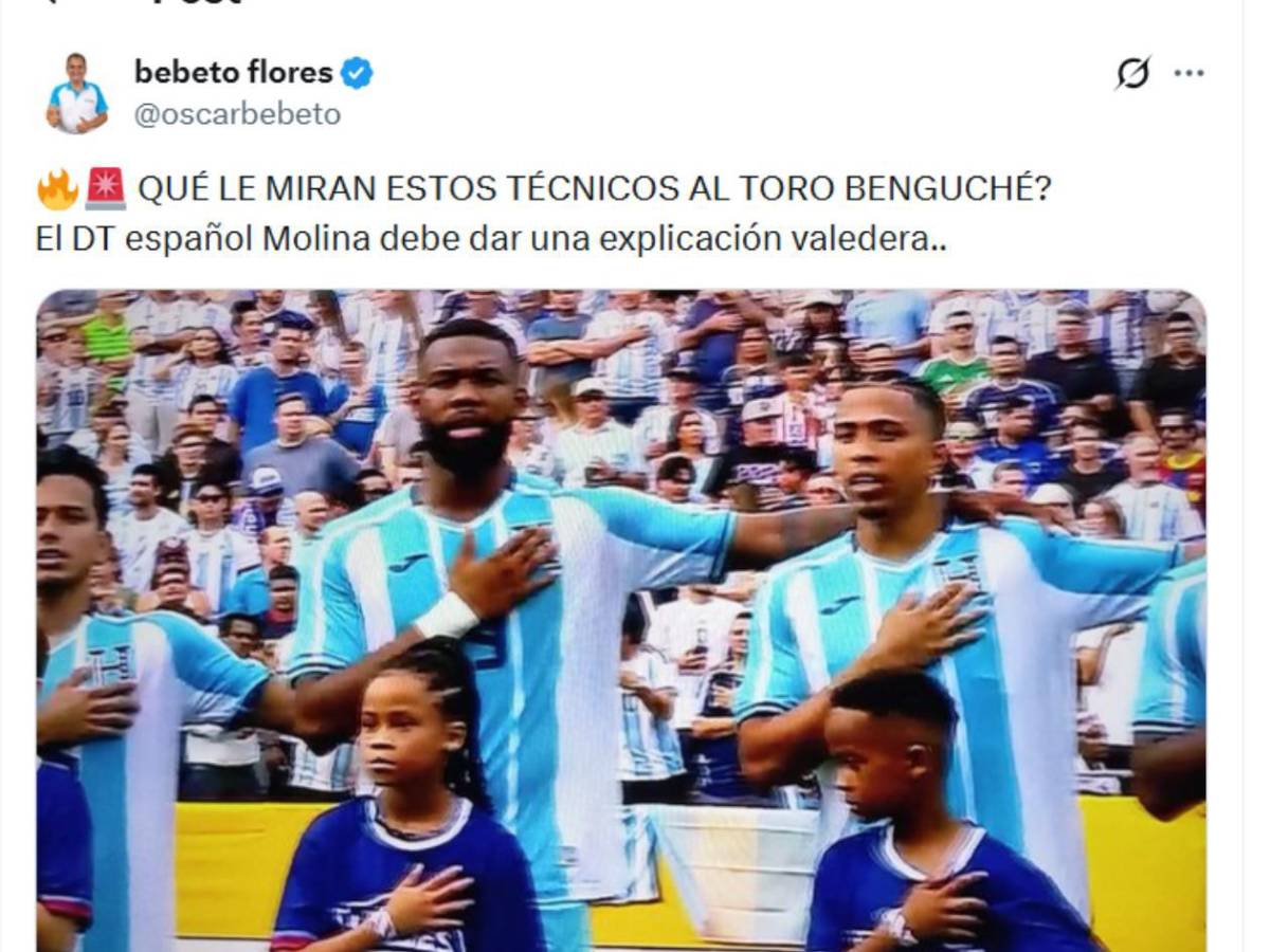Futbolista de Liga Nacional señala al Búho Meléndez tras el Argentina - Honduras