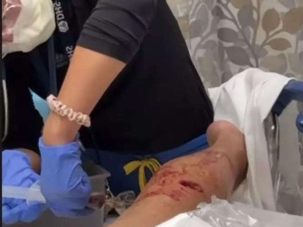 Querida actriz de Televisa sufre ataque de un pitbull: Puedo perder una extremidad