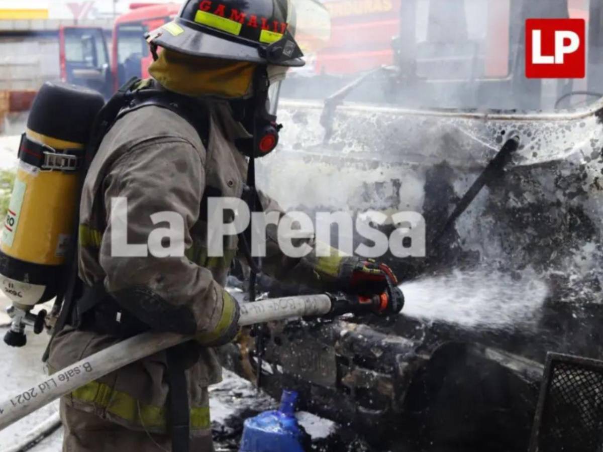 Revelan el estado clínico del hombre que sufrió quemaduras tras accidente en SPS