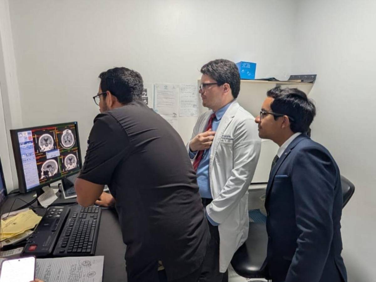 ¿Cómo reconocer a tiempo un derrame cerebral?