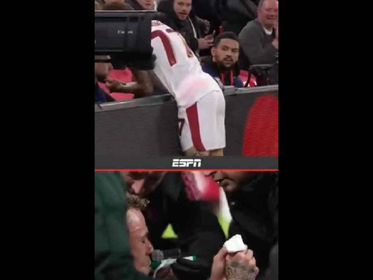 Impactante relato tras insólita lesión en Champions: “Mi pulgar quedó colgando”