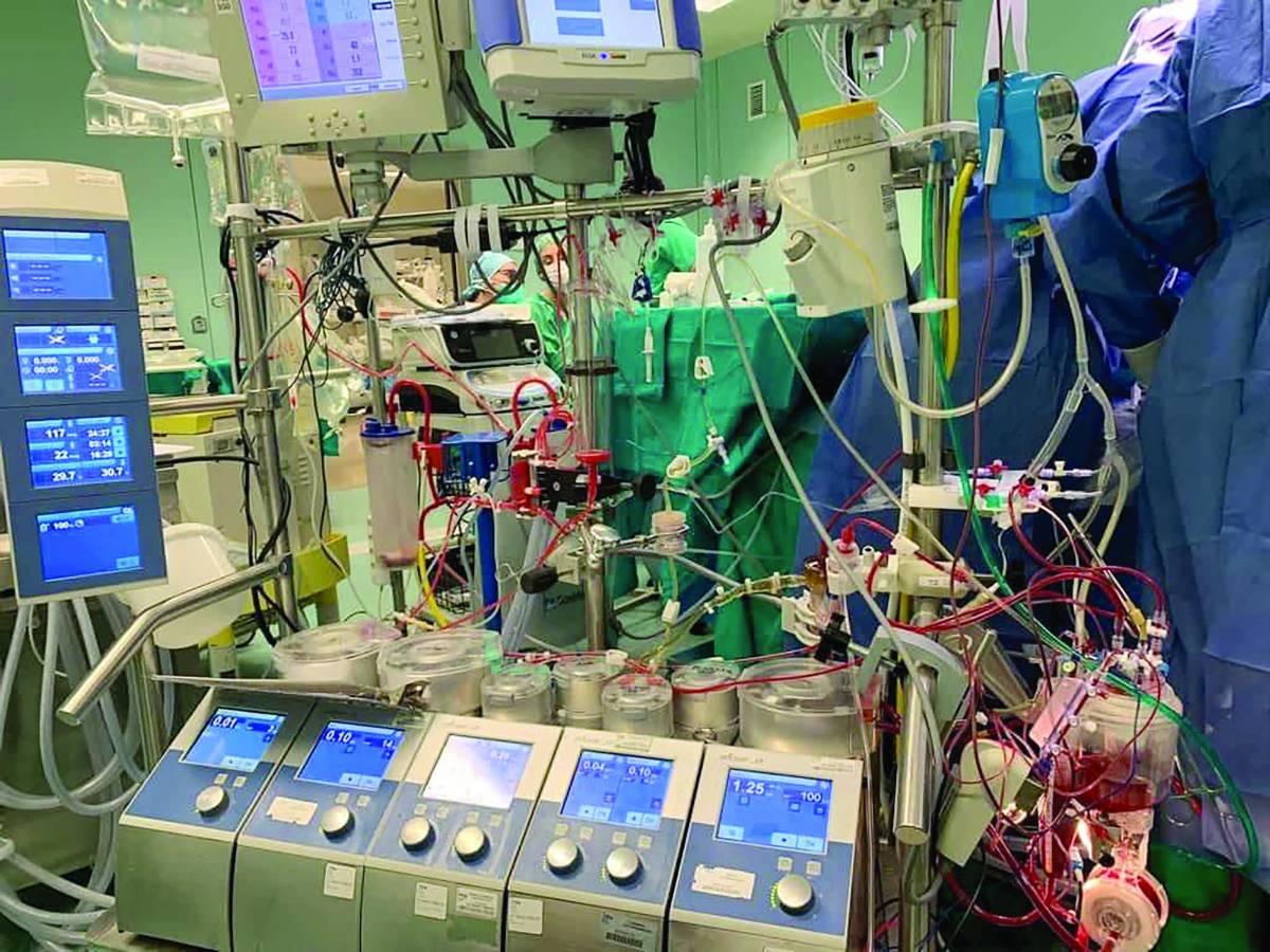 Operarán a bebés mañana en el IHSS de San Pedro Sula