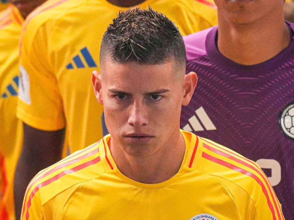 ¿James Rodríguez sufre de rabdomiólisis mortal? Surge noticia sobre el colombiano