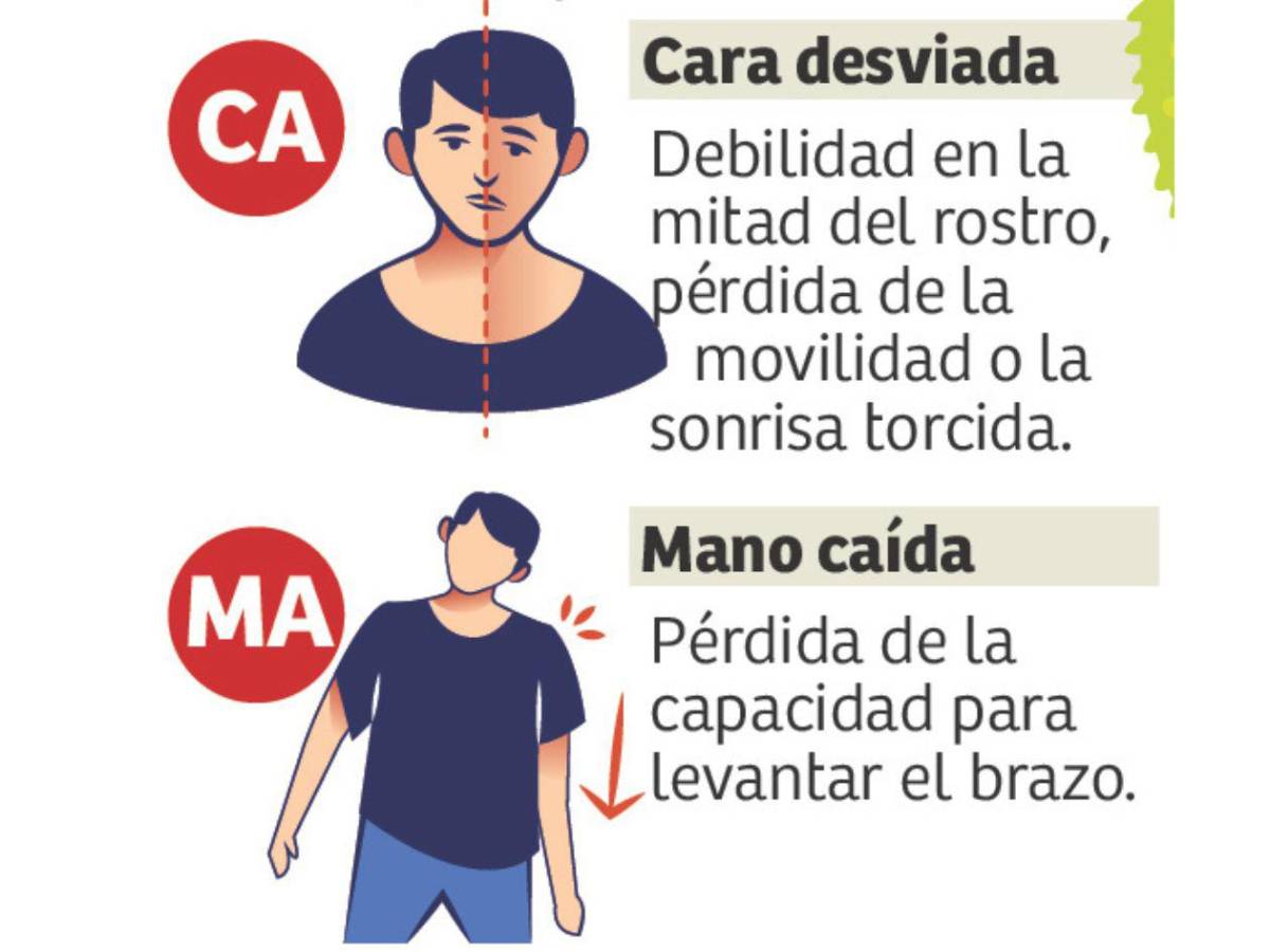 ¿Cómo reconocer a tiempo un derrame cerebral?