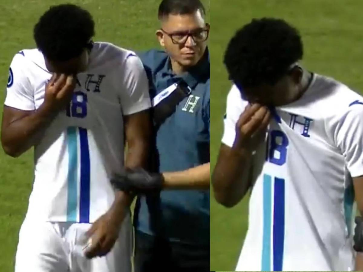 Llanto de Dereck Moncada, decepción de Molina con Honduras y sexy chica cautivó ante Surinam