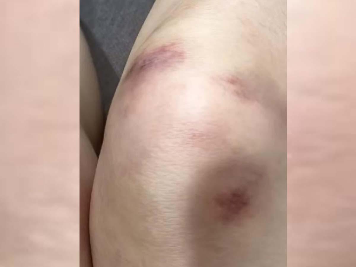 Joven usó inteligencia artificial para fingir su propio secuestro y terminó capturada