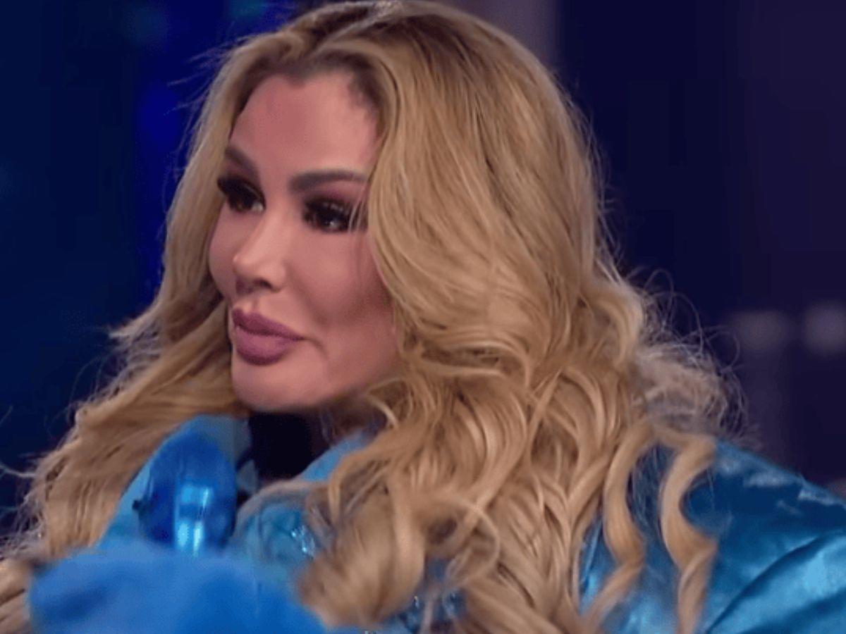 Ninel Conde no descarta más cirugías en su rostro: “Nunca es suficiente”