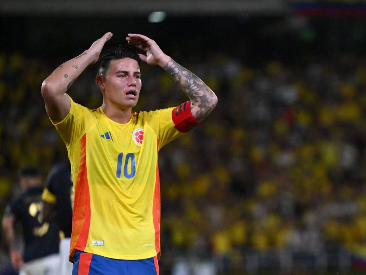 James Rodríguez en alerta: hospitalizado a dos meses del Mundial 2026
