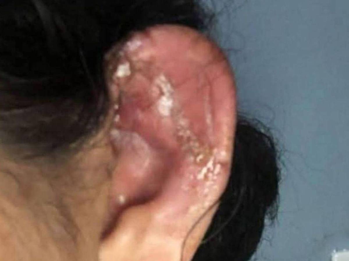 Amenazó con matar a mi mamá o mi papá: Dayani tras ser atacada a mordidas por su expareja