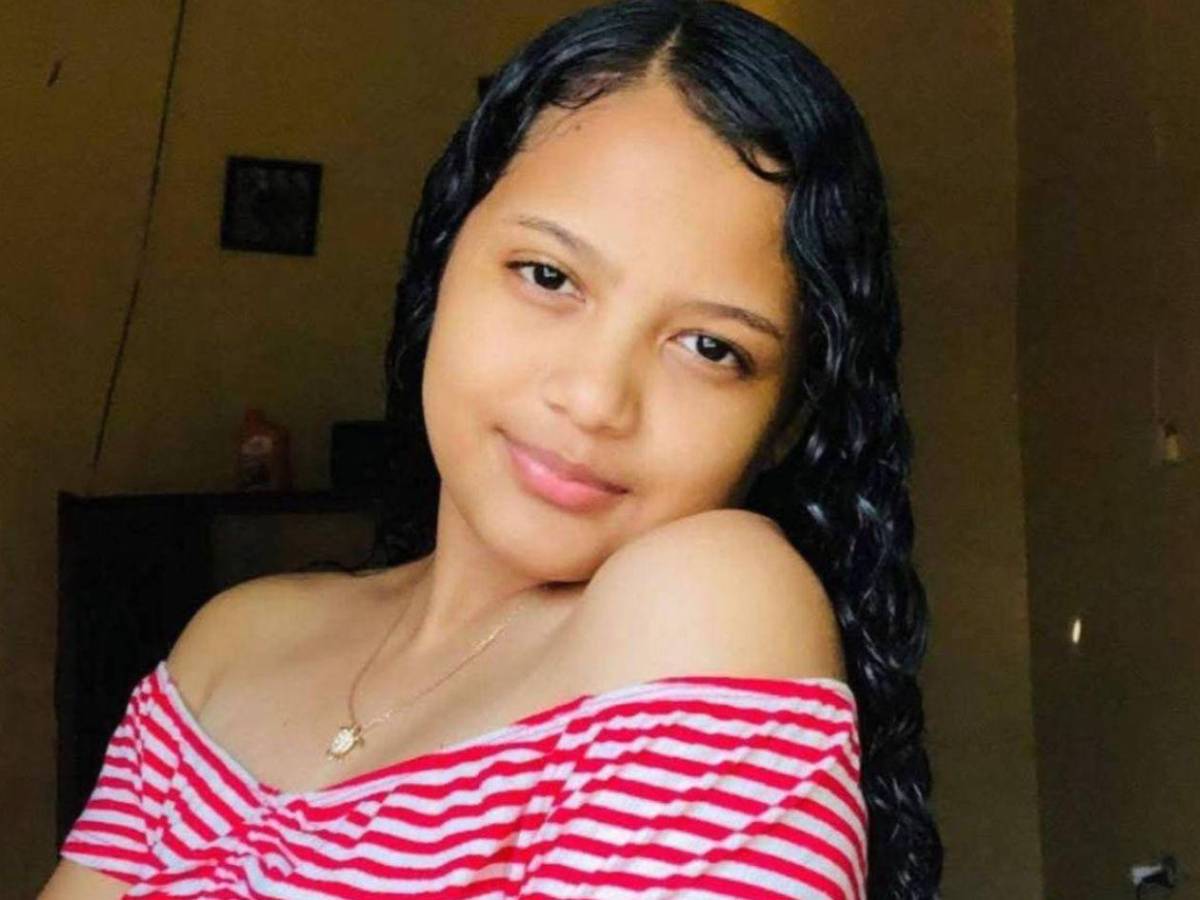 Amenazó con matar a mi mamá o mi papá: Dayani tras ser atacada a mordidas por su expareja