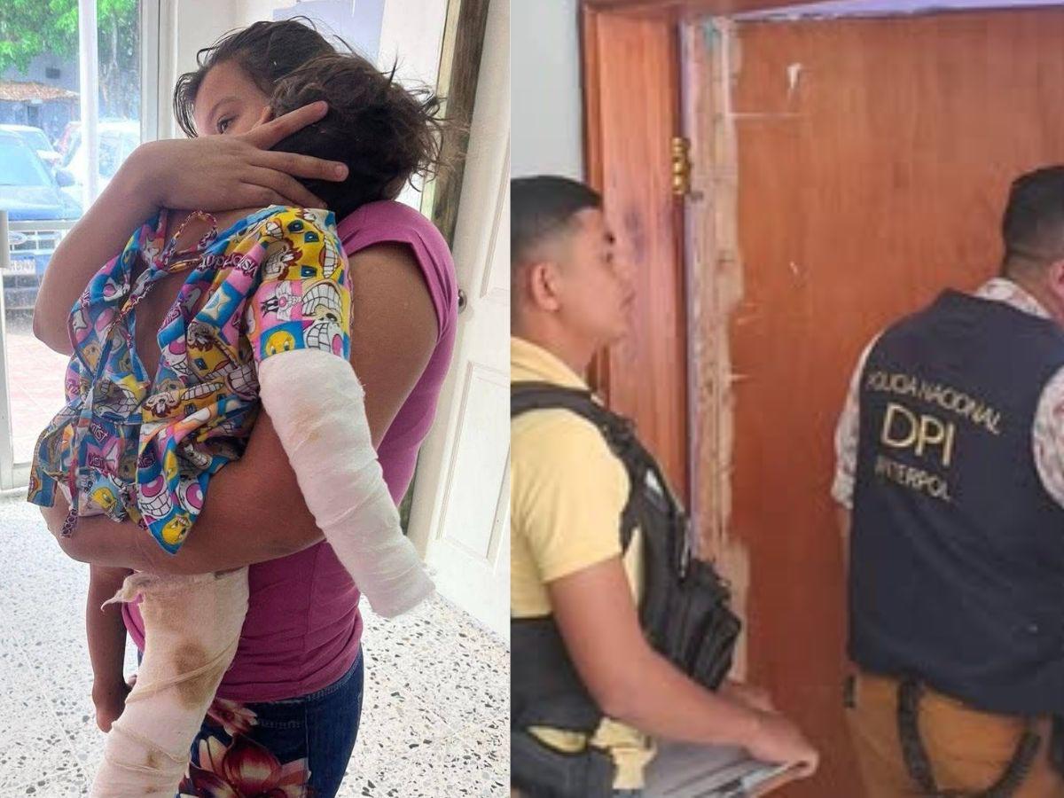 “Le quemó y fracturó”: DPI va tras padrastro acusado de torturar a niño en Santa Bárbara