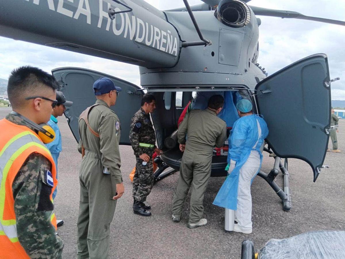 Menor quemada en explosión de pólvora en Copán es trasladada a Tegucigalpa