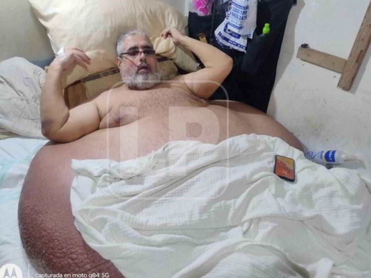 Así alistan hospital para atender de emergencia al hombre más obeso de Honduras